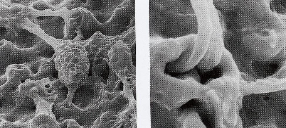 Prolifération des cellules osseuses