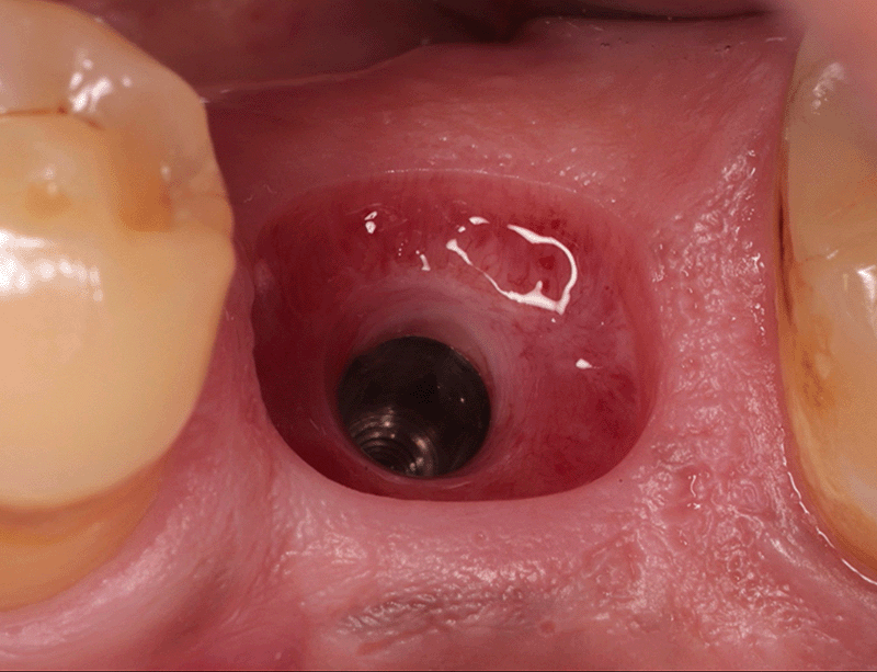 Formation Gestion du profil d'émergence en e-learning