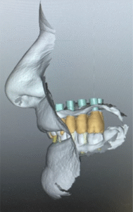 Formation e-learning chirurgie guidée : optimisez le flux digital