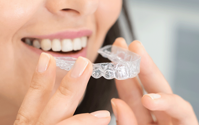Formation les aligneurs orthodontiques en omnipratique