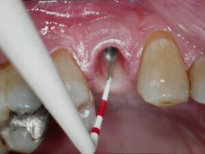 Examen clinique de l'espace biologique