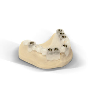 Guide chirurgical en implantologie