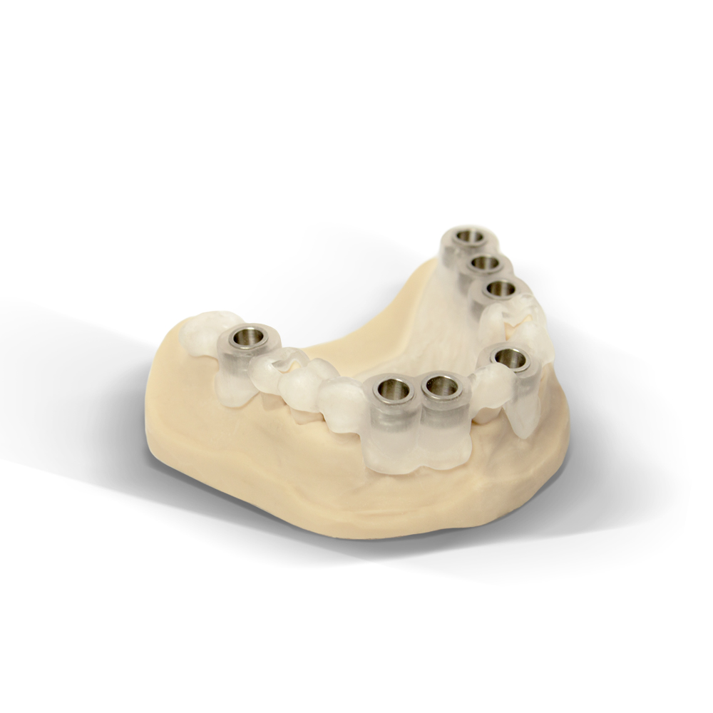 Guide chirurgical en implantologie